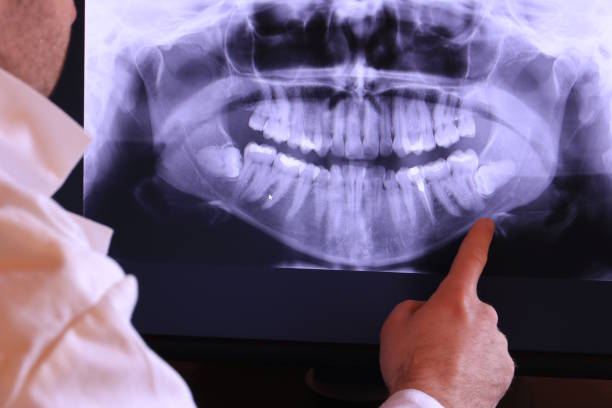 Best Emergency Gum Treatment in Amerin Nyon, CA