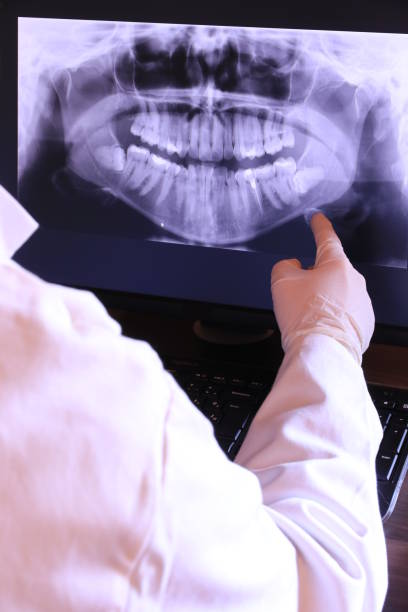 Best Emergency Root Canal Treatment in Amerin Nyon, CA