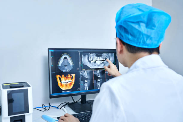Best Emergency Treatment for Dental Infections or Abscesses in Amerin Nyon, CA